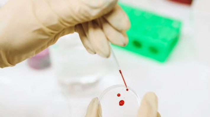 Gesundheitsmessungen jetzt in Ihrer Stadtapotheke!